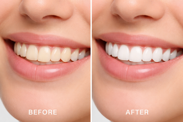 Customer result