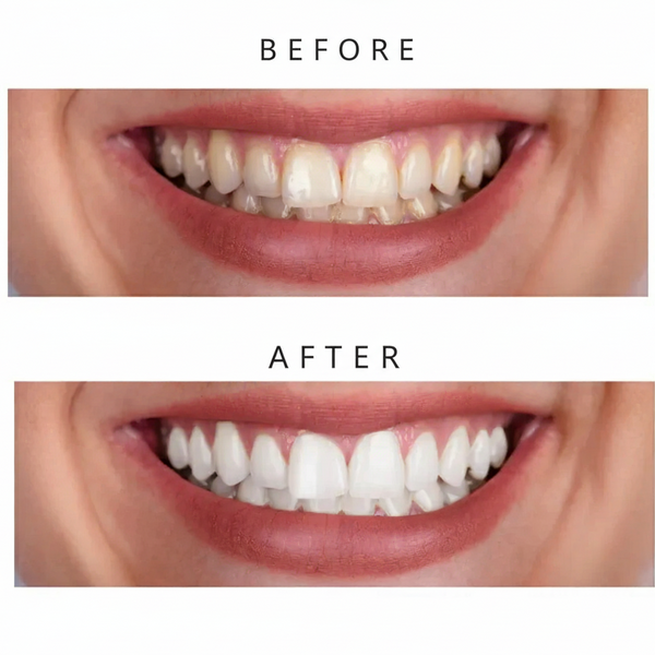 GlowHaus™ PAP+ Purple Teeth Whitening Strips – Peroxide-Free & Enamel Safe